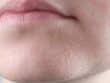 Pelle secca e pruriginosa per gli Over 60